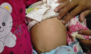 Galen (8 Bulan) Mengalami Pembengkakan Perut Butuh uluran tangan para Darmawan