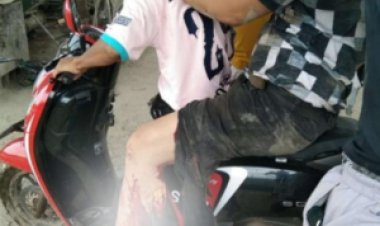 Lagi, Karyawan Perusahaan Mega Industry Morosi PT OSS Alami Kecelakaan Kerja