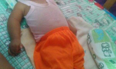 Ananda Binti Hanifah Membutuhkan Bantuan dari Berbagai Instansi Terkait