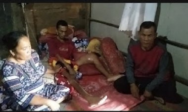 Herfika Yunanda Remaja 18 tahun Terbaring Lemah Dirumahnya dan terus berjuang, melawan penyakitnya