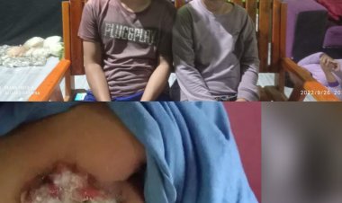 Keadaan Kasirah Penderita Kanker Payudara Memprihatinkan