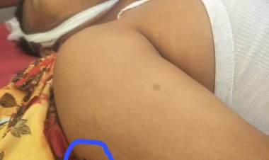 Aksi Begal Sadis kembali Menelan Korban - Warga Okut Tewas Ditembak Begal