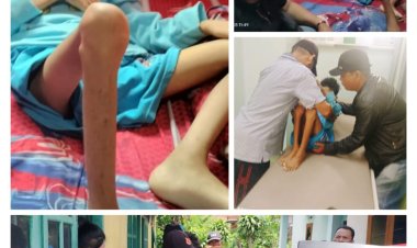 Mendapatkan laporan dari masyarakat Team Elang Mas Evakuasi pelajar SD yang terbaring lemah karena kedua kaki nya tidak bisa di Gerakan