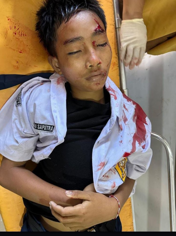 Perkelahian Siswa SMPN 12 Krui berujung maut. 29 September 2025