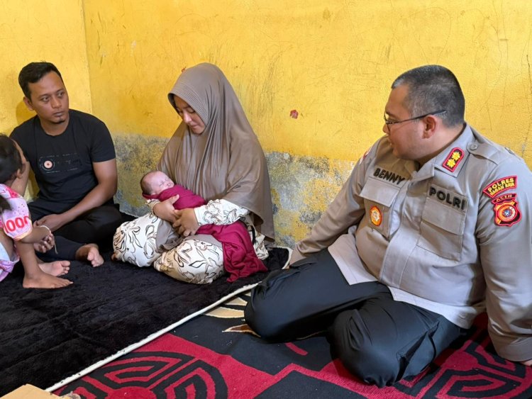 Kepedulian Nyata! Kapolres Nagan Raya Datangi Anak Bibir Sumbing Sambut Hari Bhayangkara ke-80